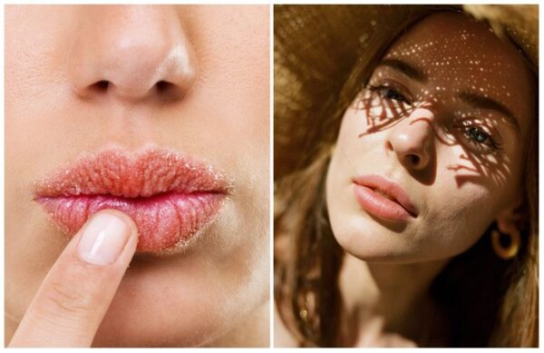 Natural-Ways-To-Have-Fuller-Lips-8423432