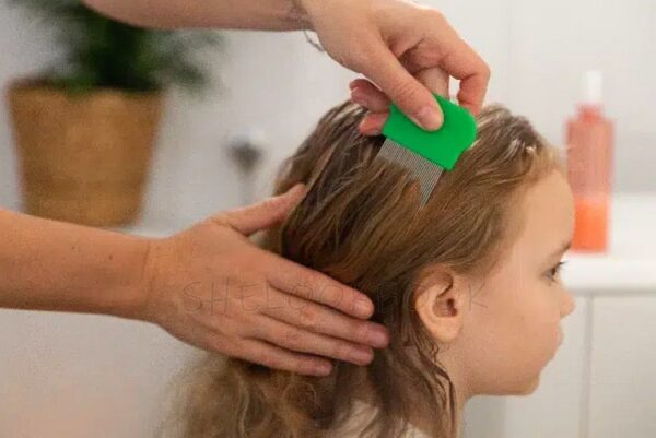 Lice Treatment